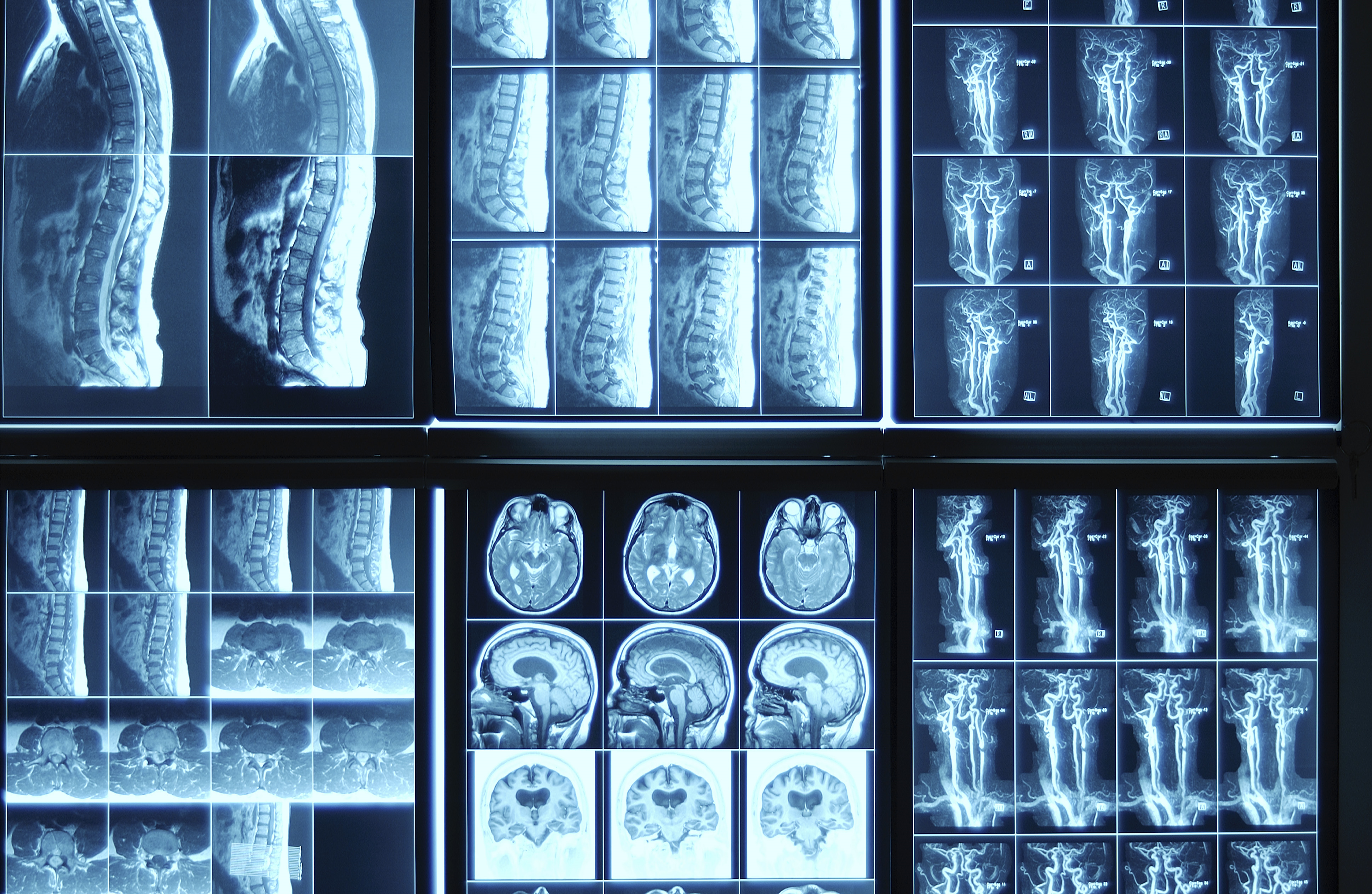방사선 기술 요소(Technical Factors of Radiology)